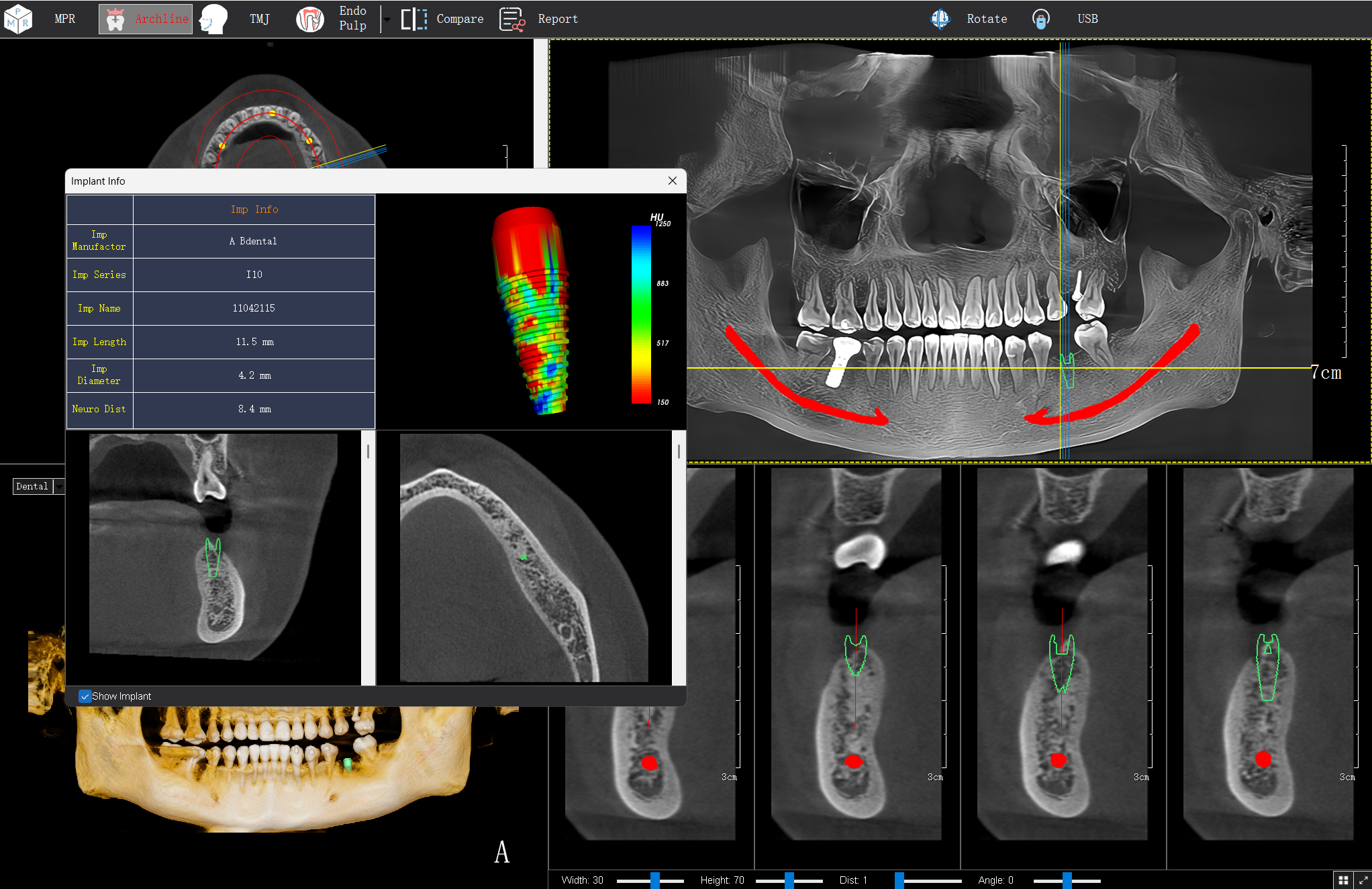 How to Choose a Cost-Effective Dental CT | CBCT Buying Guide