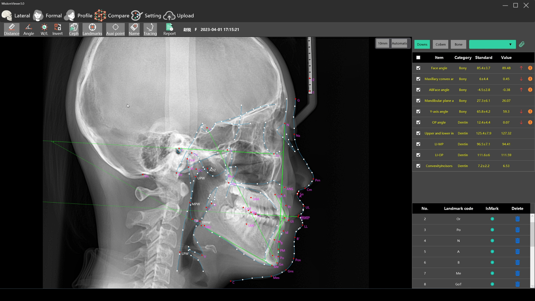 Boost Orthodontic Diagnosis: Ryder Medical Lateral Analysis & CBCT Guide