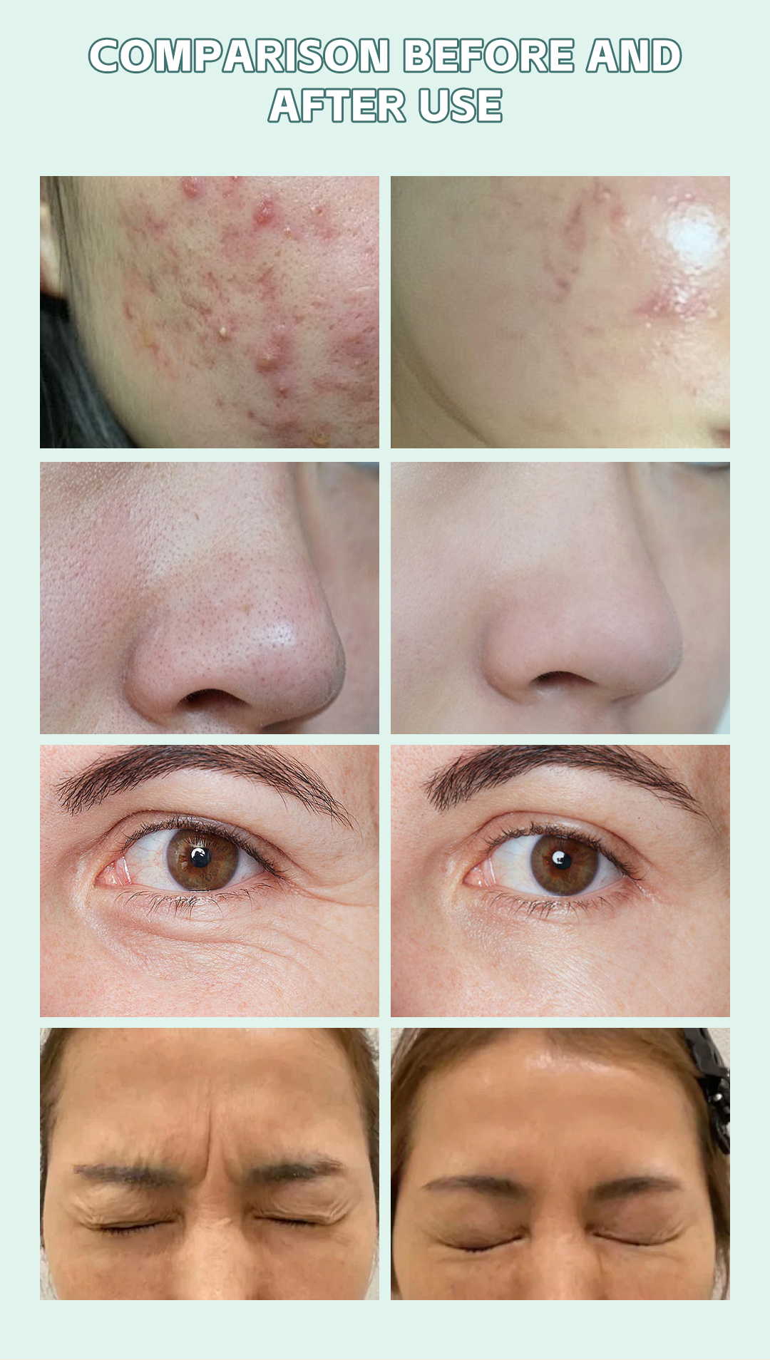 Nine in one oxygen bubble skin comprehensive instrument co2 bubble oxygenation facial machine beauty apparatus