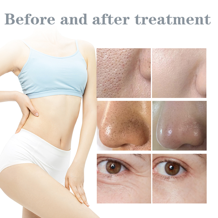 what is 9 in 1 hydra facial beauty skin machine?