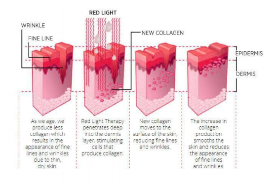 PDT SKIN BEAUTY DEVICE WITH 7 COLORS