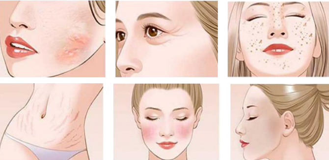 PDT SKIN BEAUTY DEVICE WITH 7 COLORS