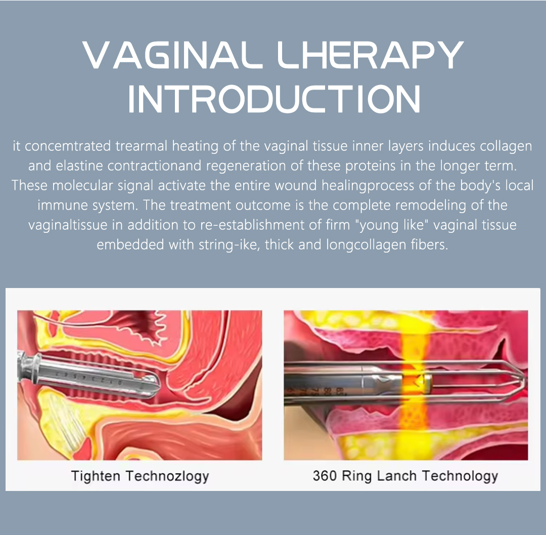 4D Vaginal Tightening CO2 Fractional Laser Machine