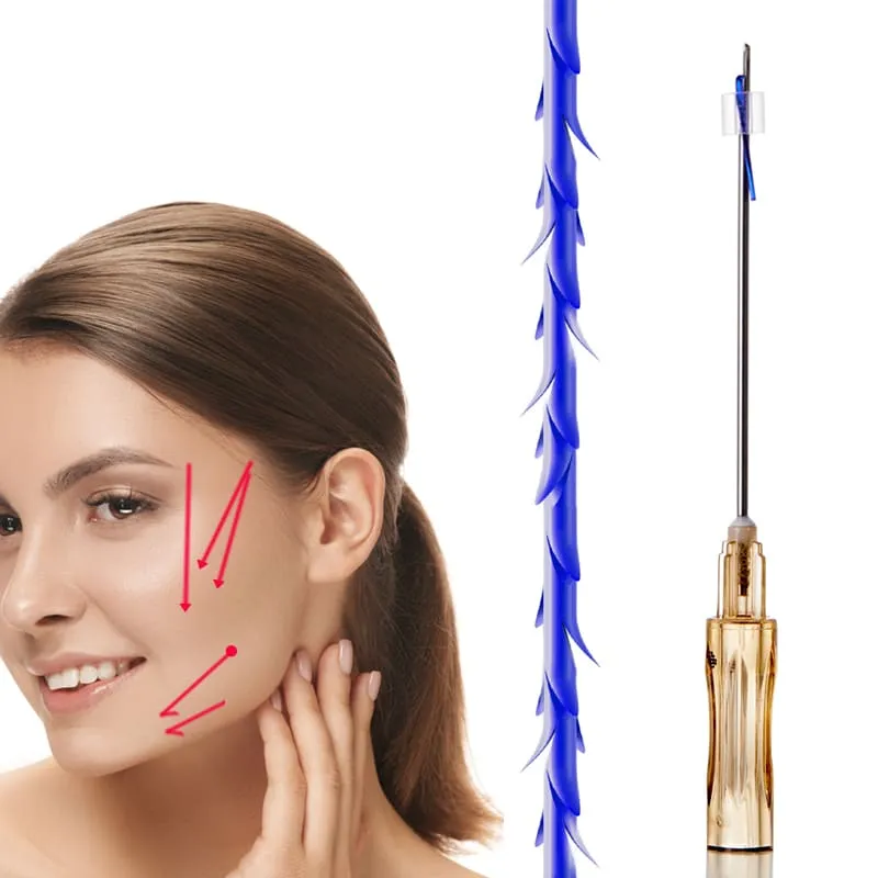 Deenora スレッドには何が含まれますか?精密製造を理解する