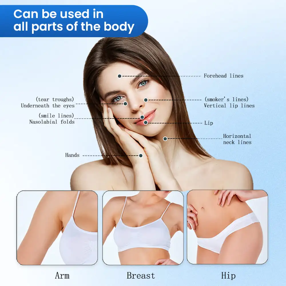 Body Contouring – Cannula-Assisted Filler Injection