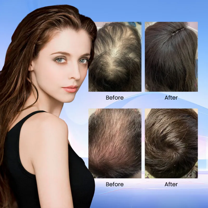 PRP Therapy – Platelet-Rich Plasma Treatment