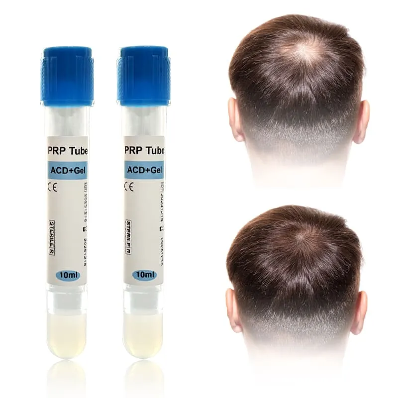 PRP Therapy – Platelet-Rich Plasma Treatment