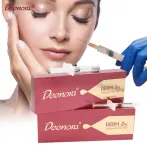 Deenora Derm hialuronsavas bőrfeltöltő az arc volumenének helyreállítására