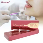 Deenora Nose & Cheek Filler térhálósított hialuronsavas bőrfeltöltő