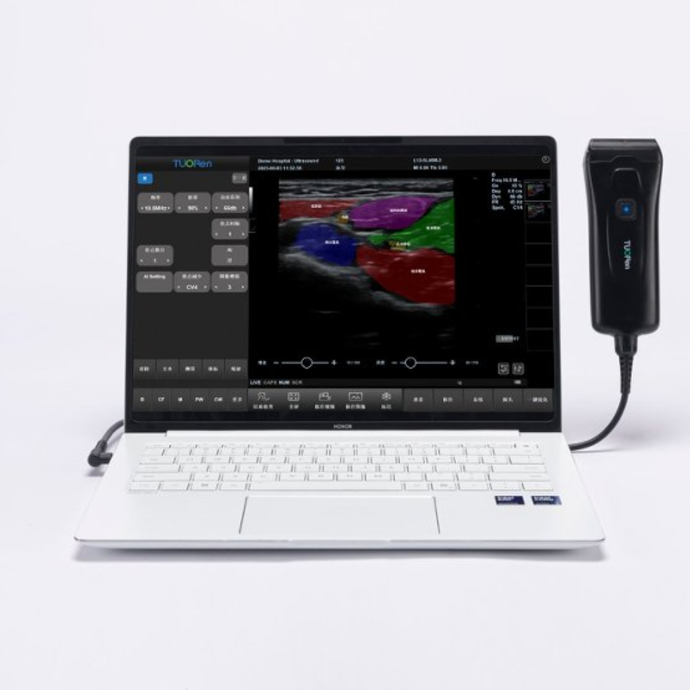 Tuoren Ultrasound 1 Probe wired ( Convex/linear/phased array) - Medical Grade
