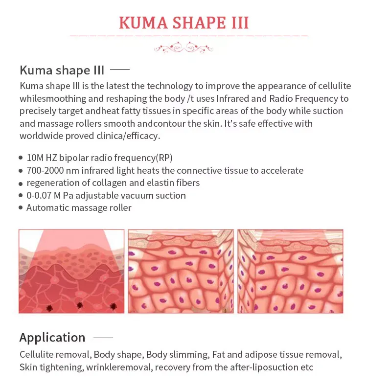KUMA Body Shape X weight loss slimming vacuum roller massage