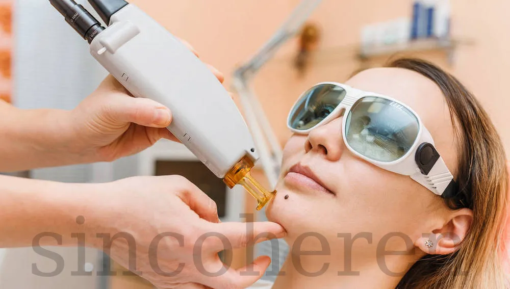Razorlase Mini Diode Laser Hair Removal Machine